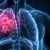 Pruebas de biomarcadores y medicina personalizada, claves para diagnosticar y tratar el cáncer colorrectal y de pulmón 